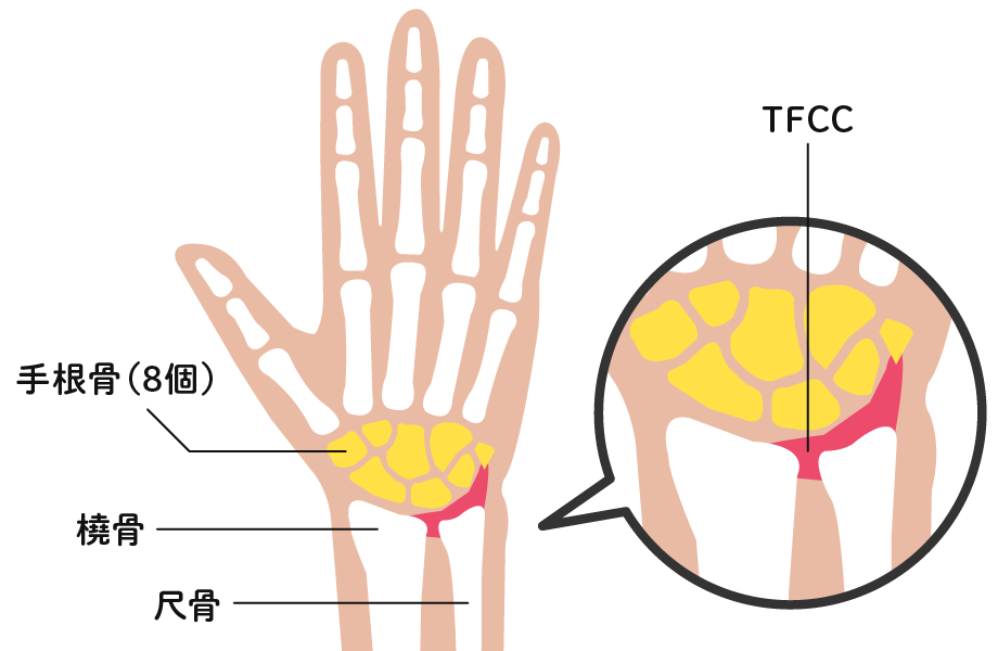 TFCCの場所を示した図。